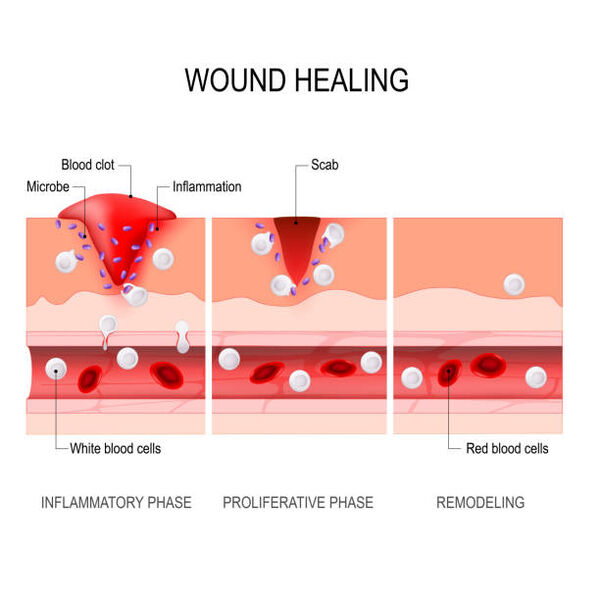 Wound-healing